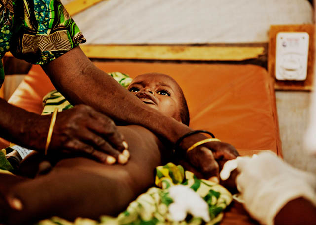 Child with malaria and malnutrition in Niger. Photo: Juan Carlos Tomasi