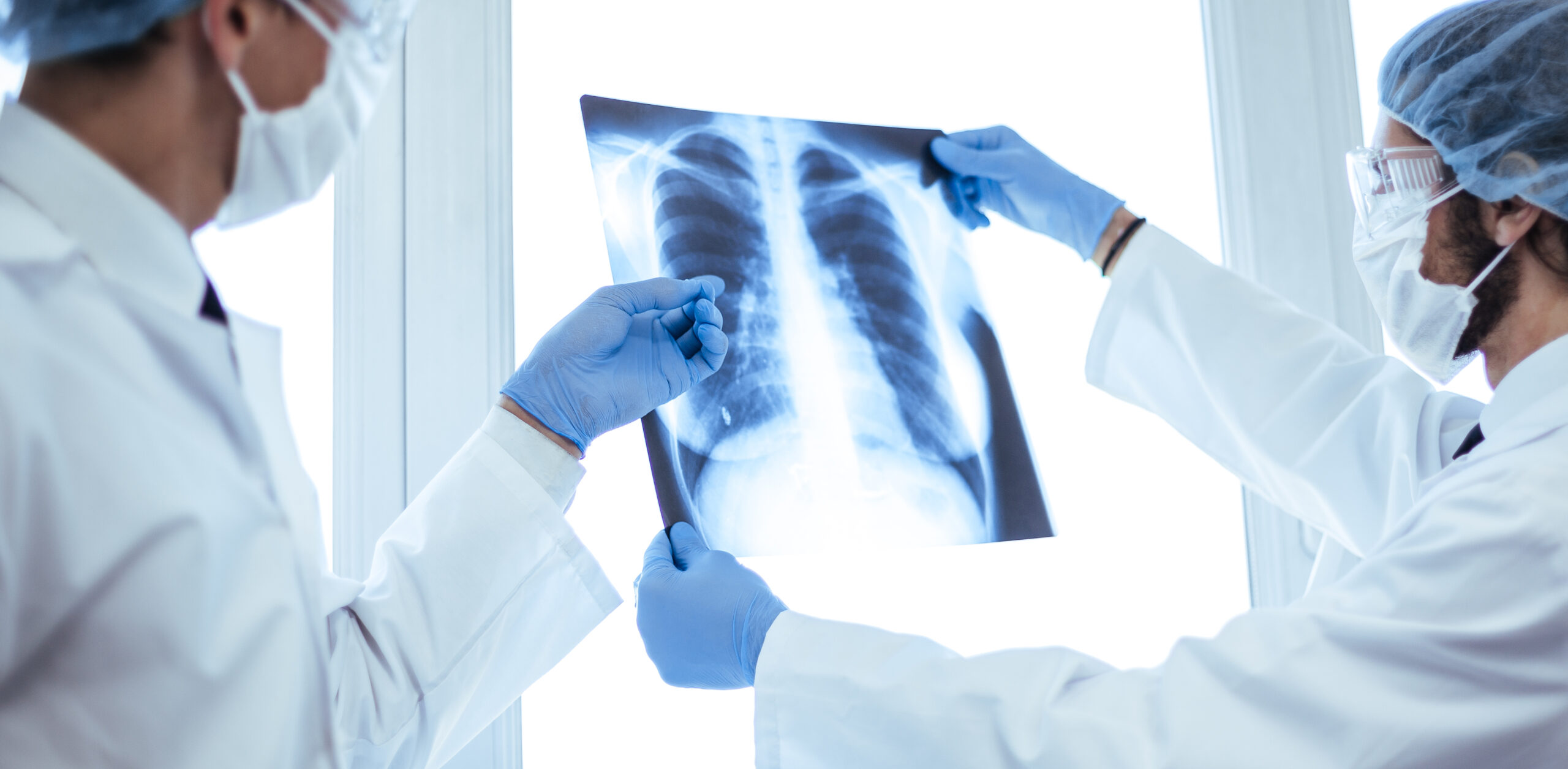 reduce the rising rates of TB in the UK 